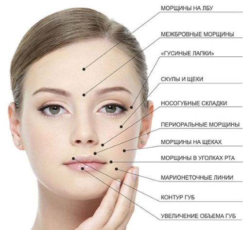 Relatox ou Botox - quel est le meilleur? Comparaison des injections de beauté