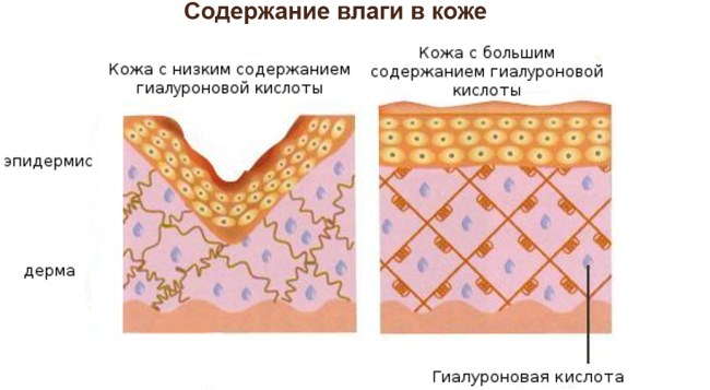 Injections d'acide hyaluronique pour le visage (lèvres, sous les yeux, front). Photos avant et après