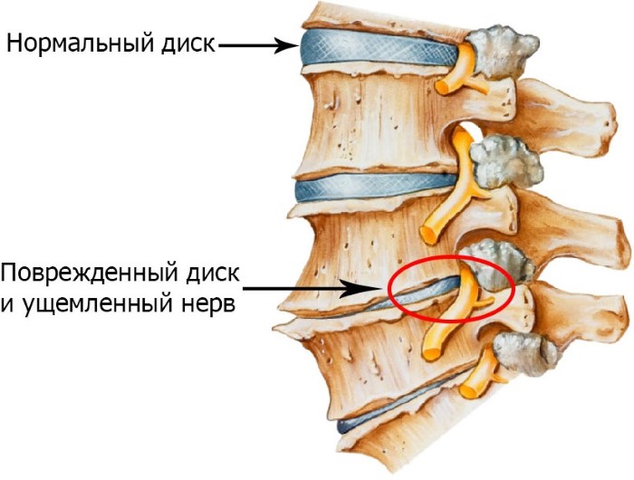 Exercices du Dr Shishonin pour le cou avec ostéochondrose. Complexe de gymnastique, vidéo