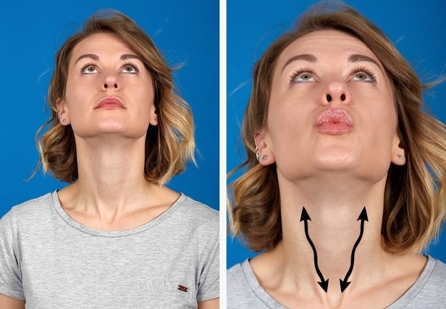 Facelift pour le visage - exercices, chirurgie, lifting