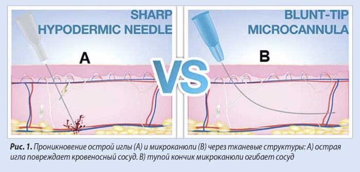 Canule en cosmétologie et médecine