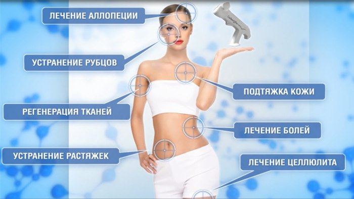 Carboxythérapie - traitement du visage, injections de gaz pour le dos et les articulations, pour l'ostéochondrose