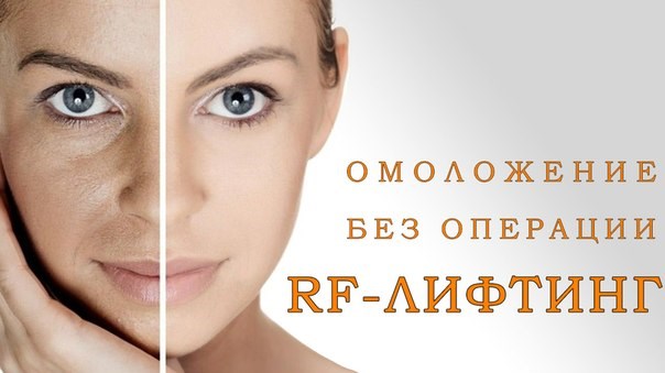 Lifting du visage - quelle est cette procédure. RF-lifting, fils faciaux, levage non chirurgical