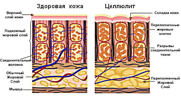 Massage de drainage lymphatique. Quelle est cette procédure pour perdre du poids, du matériel, des massages à domicile. Photo, vidéo