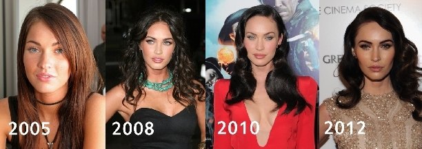 Megan Fox avant et après la chirurgie plastique du visage. Photo de chirurgie plastique des lèvres, des yeux, du nez, des pommettes