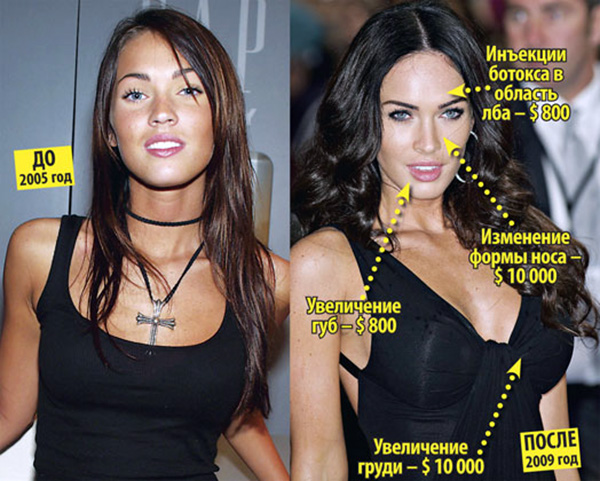 Megan Fox avant et après la chirurgie plastique du visage. Photo de chirurgie plastique des lèvres, des yeux, du nez, des pommettes