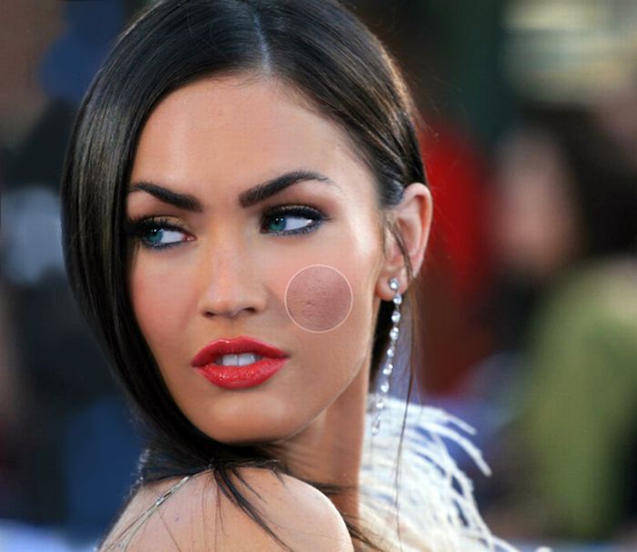 Megan Fox avant et après la chirurgie plastique du visage. Photo de chirurgie plastique des lèvres, des yeux, du nez, des pommettes