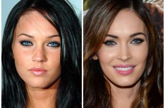 Megan Fox avant et après la chirurgie plastique du visage. Photo de chirurgie plastique des lèvres, des yeux, du nez, des pommettes