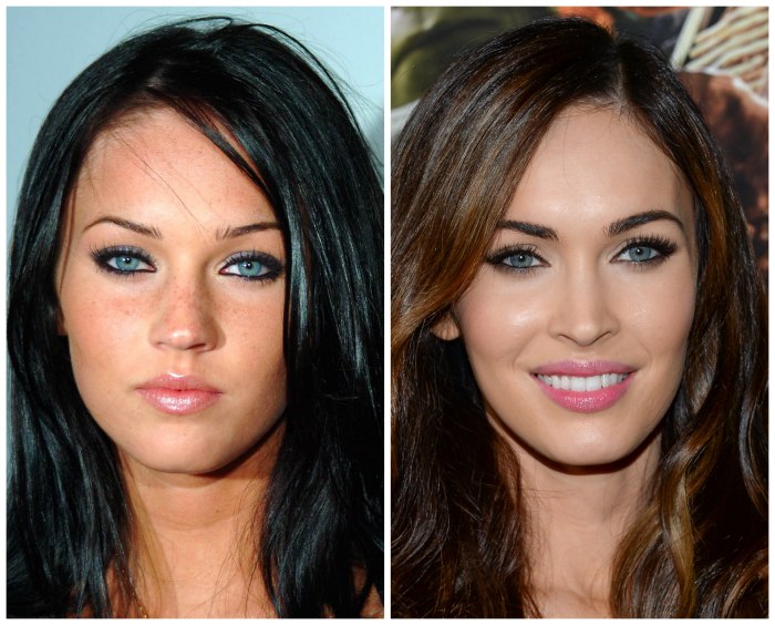 Megan Fox avant et après la chirurgie plastique du visage. Photo de chirurgie plastique des lèvres, des yeux, du nez, des pommettes