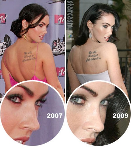 Megan Fox avant et après la chirurgie plastique du visage. Photo de chirurgie plastique des lèvres, des yeux, du nez, des pommettes