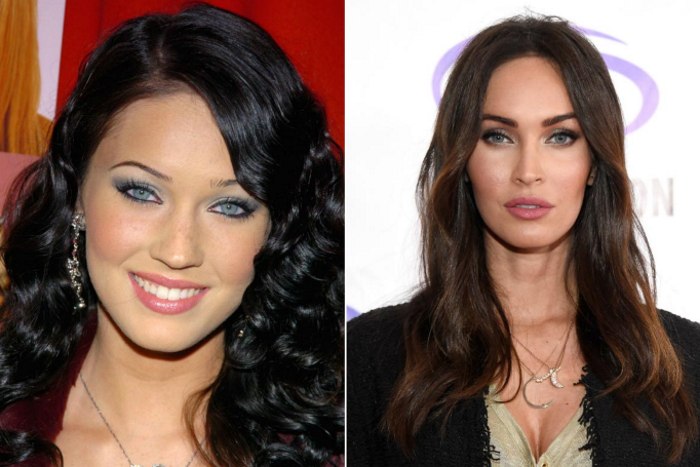 Megan Fox avant et après la chirurgie plastique du visage. Photo de chirurgie plastique des lèvres, des yeux, du nez, des pommettes