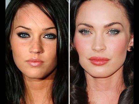 Megan Fox avant et après la chirurgie plastique du visage. Photo de chirurgie plastique des lèvres, des yeux, du nez, des pommettes