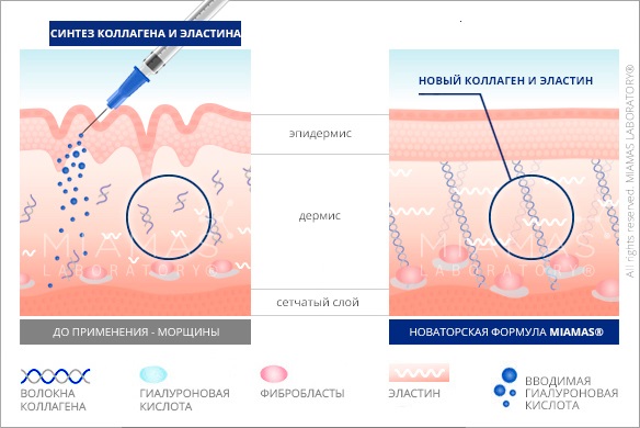 Bioréparation - qu'est-ce que c'est, l'action de la procédure, l'effet, les médicaments utilisés: Gialripier, Aquashine, photo, prix, avis