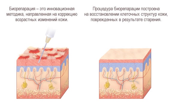 Bioréparation - qu'est-ce que c'est, l'action de la procédure, l'effet, les médicaments utilisés: Gialripier, Aquashine, photo, prix, avis