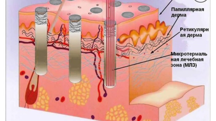 Bioréparation - qu'est-ce que c'est, l'action de la procédure, l'effet, les médicaments utilisés: Gialripier, Aquashine, photo, prix, avis