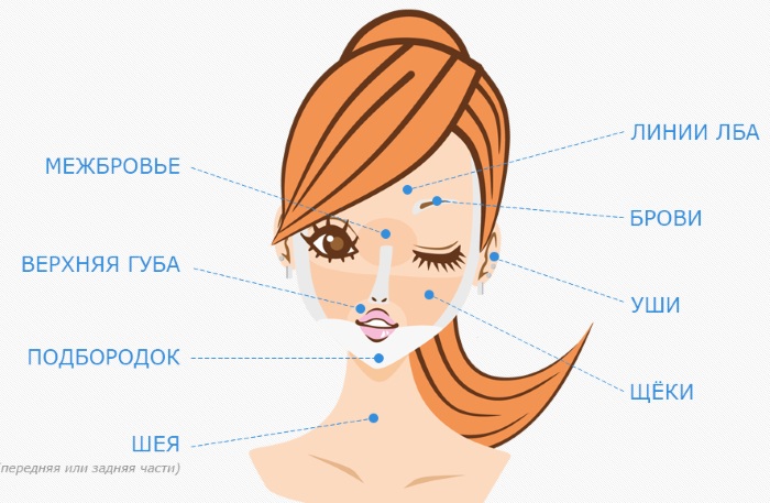 Épilation au laser pour le visage et le corps. Avis, photos avant et après, contre-indications et conséquences