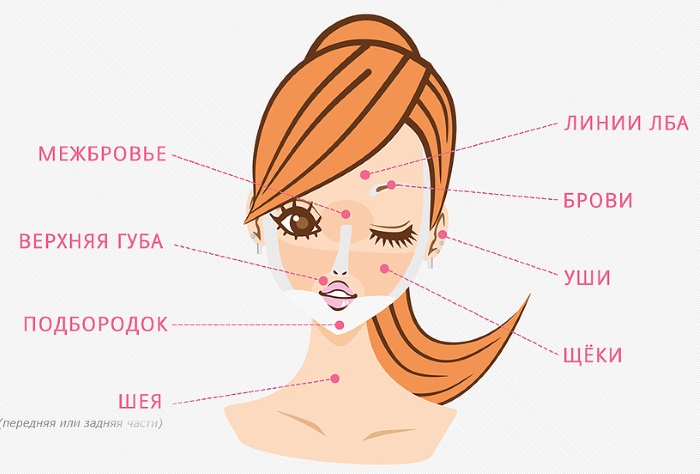 Resurfaçage au laser de la peau du visage à partir de cicatrices et de cicatrices. Photos avant et après, prix, avis. Soins de la peau à domicile après la procédure