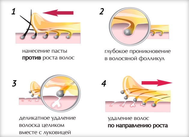 Shugaring à la maison. Comment épiler les jambes et la zone du bikini. Recettes de pâte à sucre, instructions photo