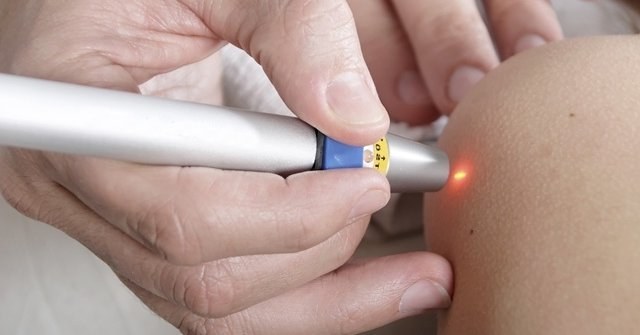 Élimination des grains de beauté au laser, méthode chirurgicale, à domicile. Conséquences, combien de temps la plaie guérit, cicatrices