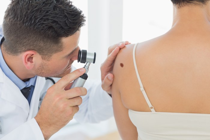 Élimination des grains de beauté au laser, méthode chirurgicale, à domicile. Conséquences, combien de temps la plaie guérit, cicatrices