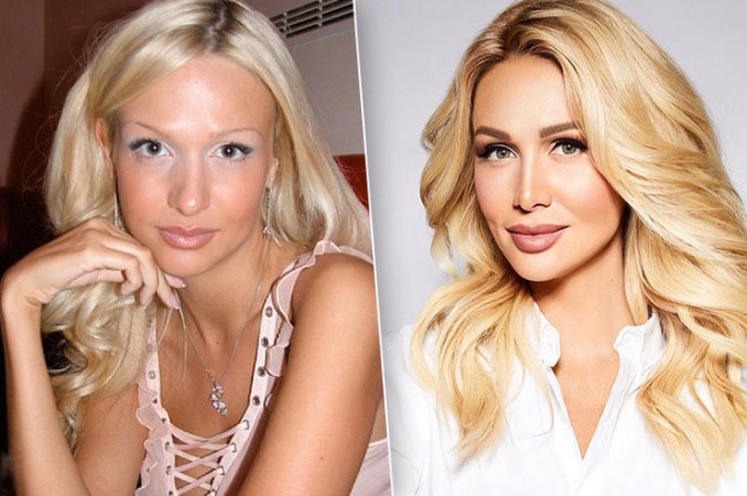 Victoria Lopyreva. Photos avant et après chirurgie plastique, croissance, biographie, vie personnelle, basque, Instragram