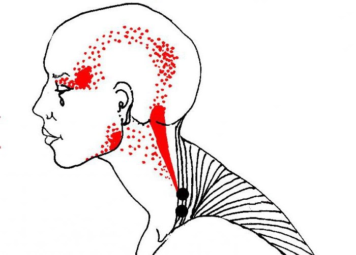 Massage myofascial - qu'est-ce que c'est, apprendre à masser le visage, le corps, le dos. Cours photo, vidéo par Shubina