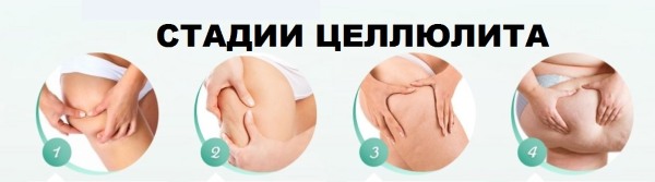 Massage anti-cellulite à domicile. Comment faire pour perdre du poids sur l'abdomen, les jambes, les fesses et d'autres parties du corps. Instructions étape par étape avec photo