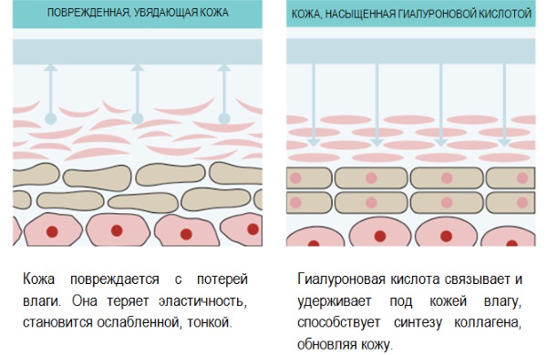 Acide hyaluronique pour le visage: mode de réalisation des injections, résultats, photos avant et après les injections, avis