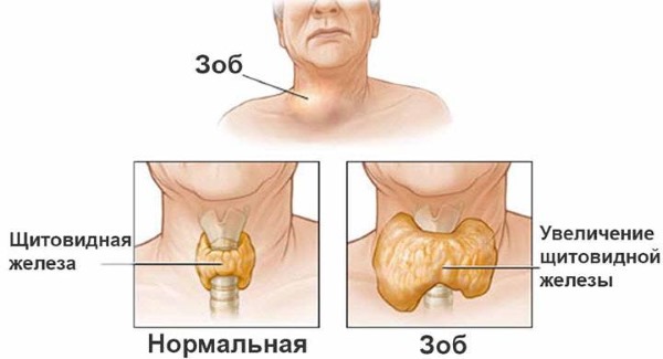 L'hormone TSH - qu'est-ce que c'est, le taux d'hormone thyroïdienne chez la femme, le traitement des niveaux bas et élevés