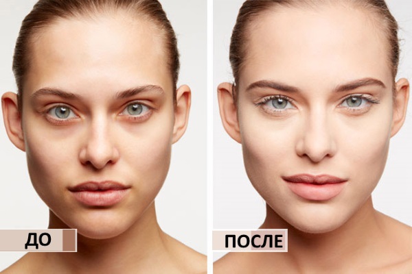 Comment réduire le nez, remodeler sans chirurgie, visuellement avec du maquillage, du correcteur, des cosmétiques, des exercices et des injections