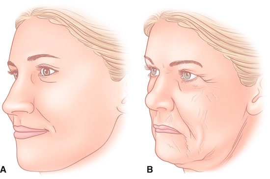 Lifting SMAS - nettoyage du visage par ultrasons. Caractéristiques de la procédure, indications, contre-indications, effet attendu, photo