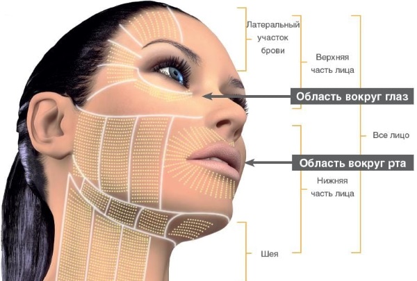 Lifting SMAS - nettoyage du visage par ultrasons. Caractéristiques de la procédure, indications, contre-indications, effet attendu, photo