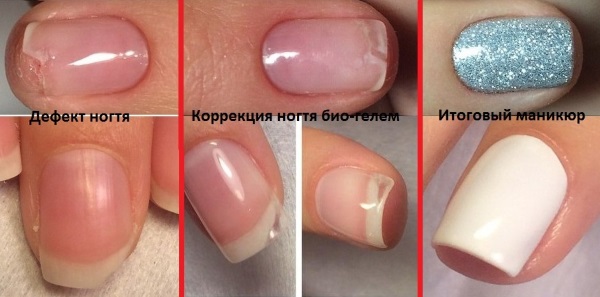 Comment renforcer les ongles avec du gel sous vernis gel. Quels gels sont les meilleurs à utiliser, comment la procédure se déroule étape par étape. Instruction avec photo