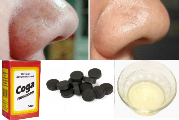 Masque facial au bicarbonate de soude pour les rides, l'acné, les points noirs, les taches de vieillesse. Recettes et usage domestique