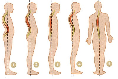 Masseurs pour le dos et le cou, le corps, avec ostéochondrose. Comment choisir pour un usage domestique