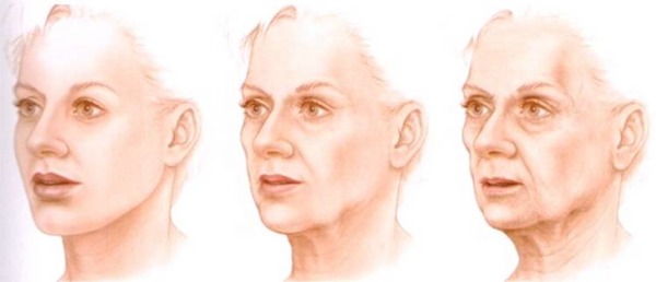 Anatomie des muscles faciaux humains en cosmétologie pour les injections de botox. Schémas avec descriptions et photos en latin et en russe