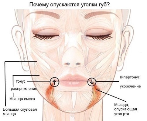 Anatomie des muscles faciaux humains en cosmétologie pour les injections de botox. Schémas avec descriptions et photos en latin et en russe