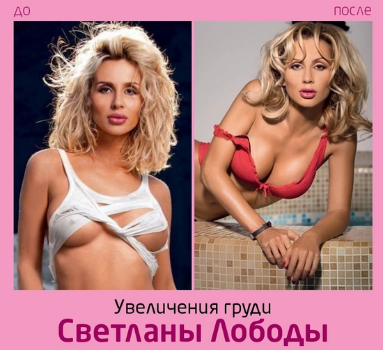 Svetlana Loboda avant et après la chirurgie plastique. Photo du visage, du nez, des lèvres, de la poitrine. Biographie du chanteur, âge, paramètres de forme, taille et poids