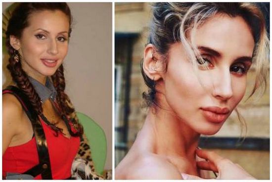 Svetlana Loboda avant et après la chirurgie plastique. Photo du visage, du nez, des lèvres, de la poitrine. Biographie du chanteur, âge, paramètres de forme, taille et poids