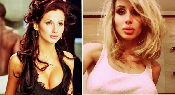 Svetlana Loboda avant et après la chirurgie plastique. Photo du visage, du nez, des lèvres, de la poitrine. Biographie du chanteur, âge, paramètres de forme, taille et poids