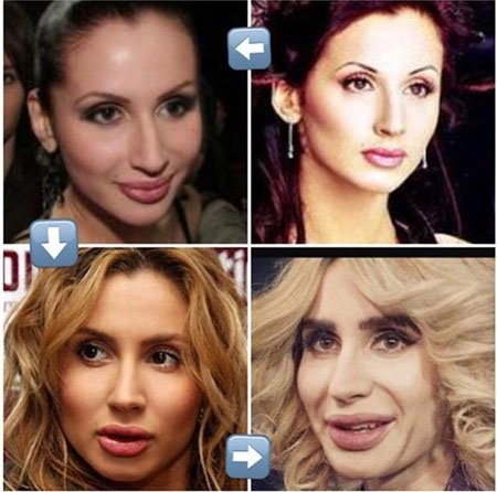 Svetlana Loboda avant et après la chirurgie plastique. Photo du visage, du nez, des lèvres, de la poitrine. Biographie du chanteur, âge, paramètres de forme, taille et poids