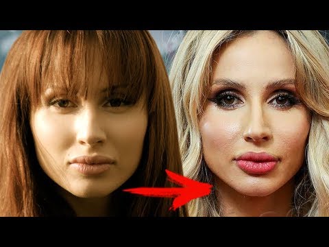 Svetlana Loboda avant et après la chirurgie plastique. Photo du visage, du nez, des lèvres, de la poitrine. Biographie du chanteur, âge, paramètres de forme, taille et poids