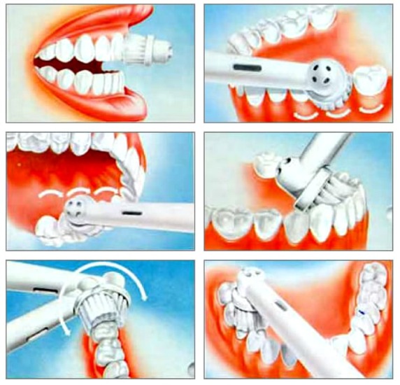 Brosse à dents à ultrasons. Avantages et inconvénients, avis des médecins, évaluation des meilleurs et contre-indications