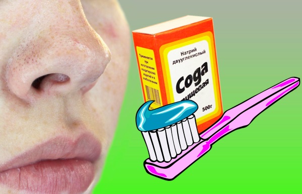 Comment appliquer du dentifrice pour l'acné sur le visage. Recette de préparation et d'utilisation, photo