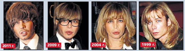 Chirurgie plastique infructueuse. Photos d'hommes et de femmes effrayantes de stars russes et hollywoodiennes