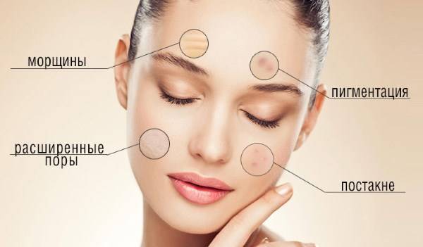 Qu'est-ce que la bio-revitalisation du visage, en quoi elle diffère de la mésothérapie, des charges. Indications, contre-indications, conséquences. Une photo