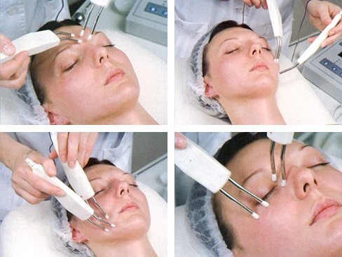 Galvanoplastie en cosmétologie - qu'est-ce que c'est, comment les procédures sont effectuées pour la peau autour des yeux, du visage et du corps, avantages et inconvénients, avantages. Appareil à usage domestique. Une photo