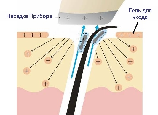 Galvanoplastie en cosmétologie - qu'est-ce que c'est, comment les procédures sont effectuées pour la peau autour des yeux, du visage et du corps, avantages et inconvénients, avantages. Appareil à usage domestique. Une photo