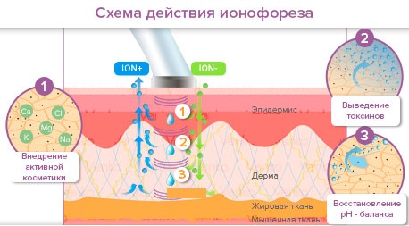 Galvanoplastie en cosmétologie - qu'est-ce que c'est, comment les procédures sont effectuées pour la peau autour des yeux, du visage et du corps, avantages et inconvénients, avantages. Appareil à usage domestique. Une photo