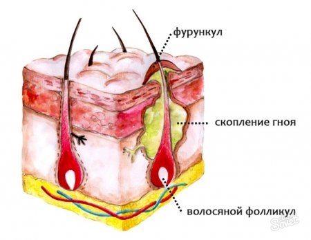 Galvanoplastie en cosmétologie - qu'est-ce que c'est, comment les procédures sont effectuées pour la peau autour des yeux, du visage et du corps, avantages et inconvénients, avantages. Appareil à usage domestique. Une photo